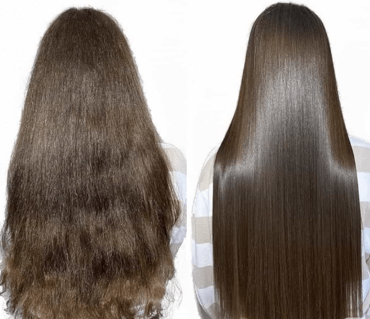 Hair Botox treatment in Kondapur
